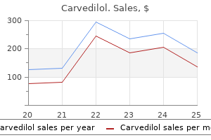 buy 25 mg carvedilol otc