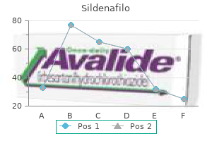 cheap sildenafilo 50 mg overnight delivery