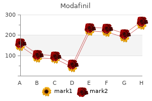 modafinil 200 mg with mastercard